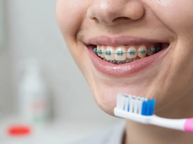 Jak poznat, že máte správně vyčištěné zuby při nošení rovnátek