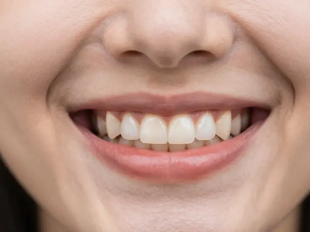 Nalepovací zuby: Jaké jsou nejlepší značky na trhu v roce 2026