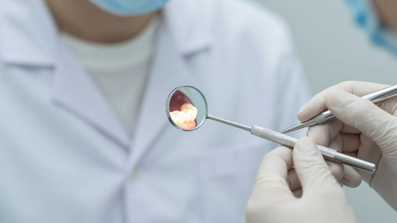 Nejlepší dentální zrcátka pro profesionální použití - výběr pro zubní lékaře a hygieničky