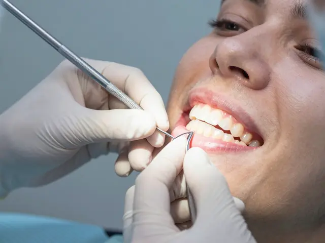 Co je fazet? Všechno, co potřebujete vědět o keramických fazetách