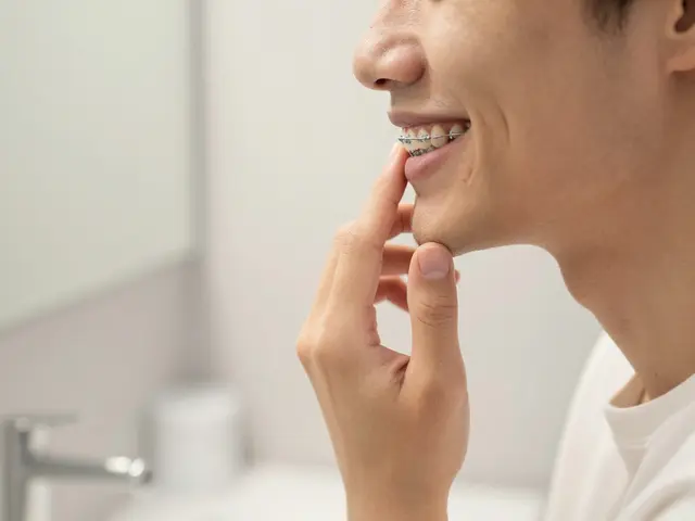 Co po rovnátkách? Co dělat po sundání ortodontického aparátu