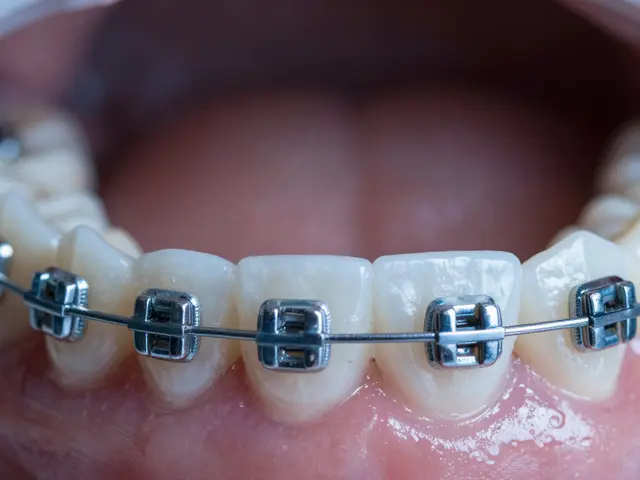 Jak se rovnají zuby? Porovnání brusk, dlah a faset