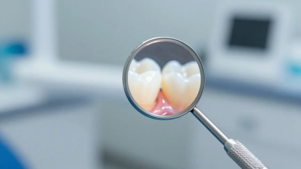 Jak dentální zrcátko pomáhá při léčení zubních chorob: Více než jen kousek skla