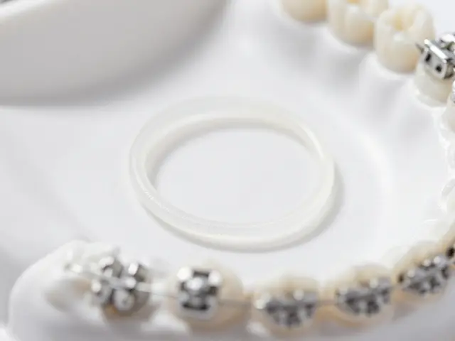 Gumičky na rovnátka: Praktický průvodce údržbou a používáním