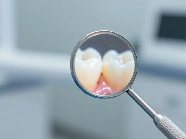 Jak dentální zrcátko pomáhá při léčení zubních chorob: Více než jen kousek skla