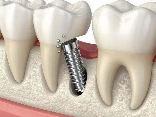 Zubní implantáty a vaše zdraví: Kompletní průvodce vlivem na tělo