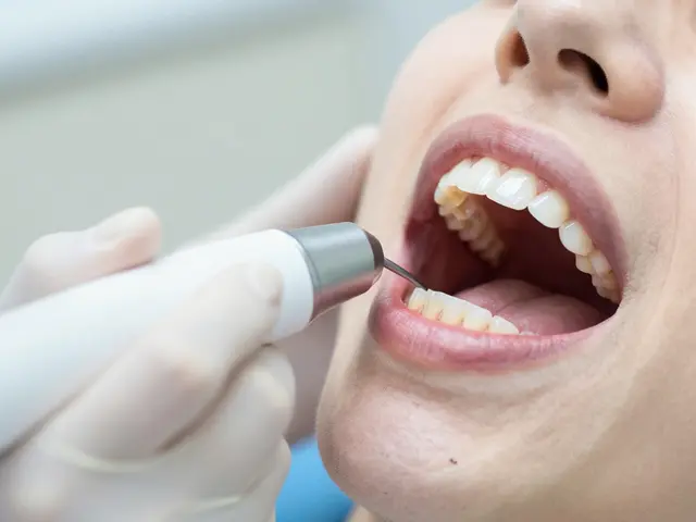 Jak často se má chodit na dentální hygienu? Kompletní průvodce